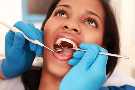 Frankford Dental Group | Preventative Program, All-on-4 reg and Dental Cleanings